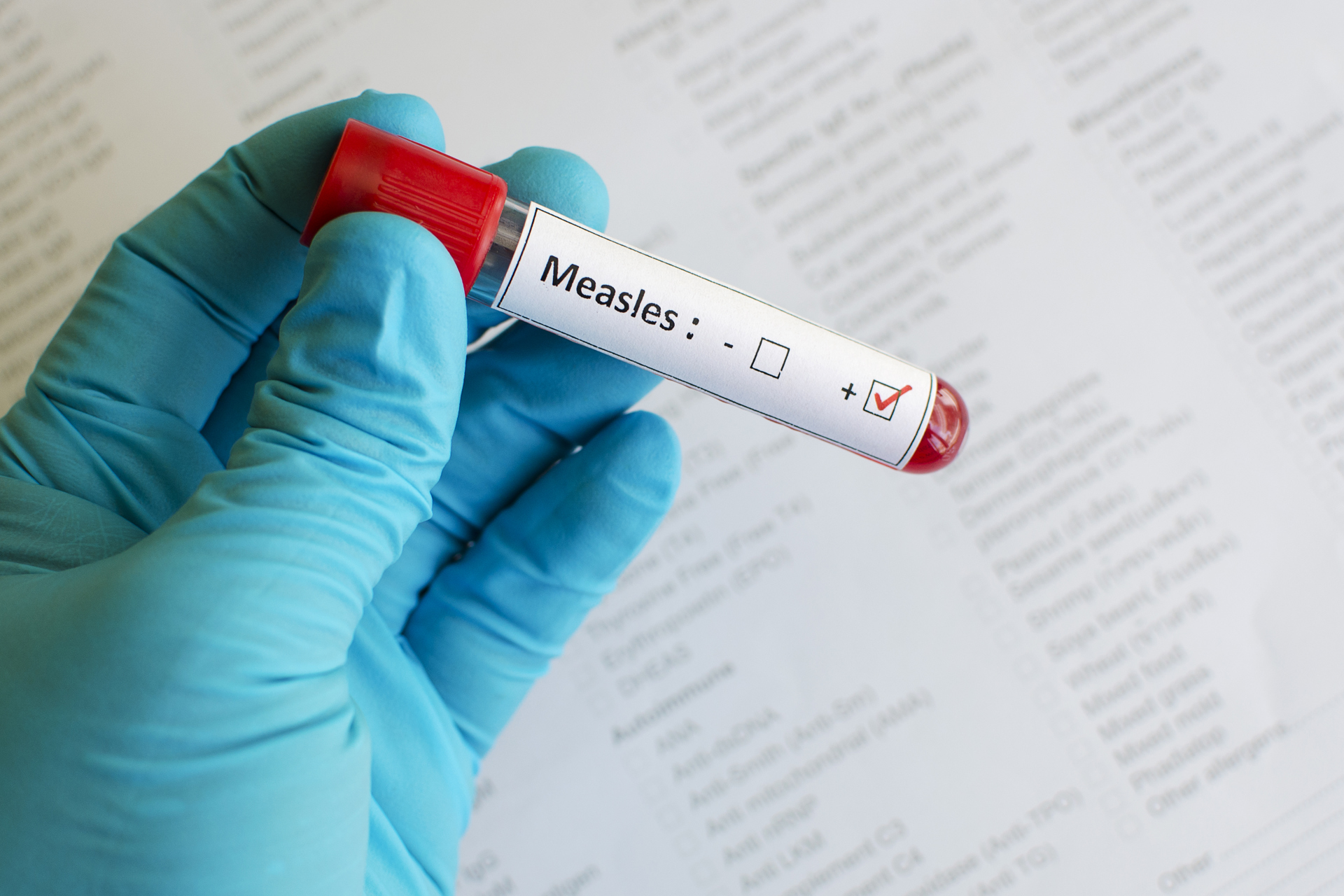 What to Know: Measles Outbreak in Ohio